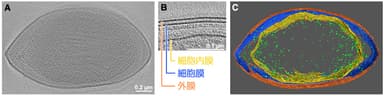 図3_RT761株の細胞の膜構造