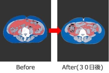内臓脂肪減少