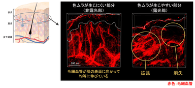 図1　組織透明化技術で観察した皮膚の内部構造