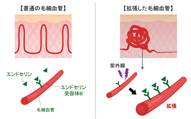 図3　毛細血管拡張のメカニズム