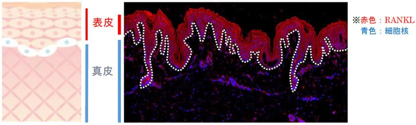 免疫と骨の健康に関わるタンパク質「RANKL」が
皮膚のバリア機能及び保湿機能を強化することを発見　
第6回日本骨免疫学会にて発表
