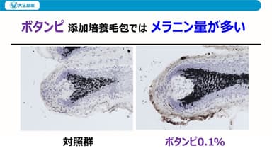 MITOLの白髪に関する新発見　講演スライド