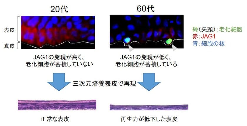 皮膚から老化細胞が排除されるメカニズムを解明
タンパク質「JAG1」が皮膚における老化細胞の排除を制御している