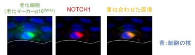 図2 老化細胞はNOTCH1を発現している