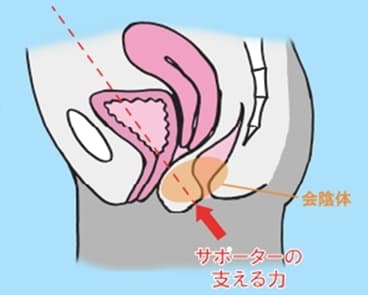 膣の後方から前面に向かう力で膣口を閉鎖