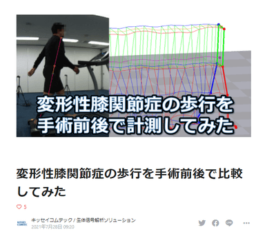 ◇ブログの記事例：「変形性膝関節症の歩行を手術前後で計測してみた」