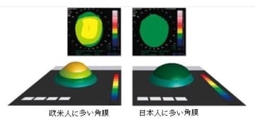 欧米人と日本人の角膜形状の違い