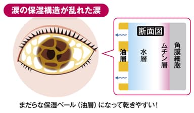 図8) 涙の保湿構造が乱れた涙