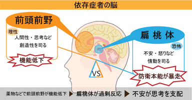 09_依存症者の脳(図解)