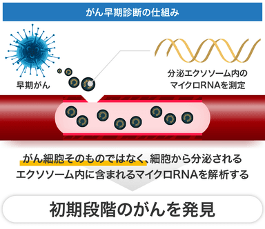 エクソソームで初期段階に発見可能