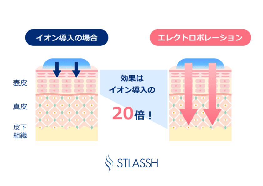 業界初の新技術、
エレクトロポレーション脱毛に新しいコースが誕生！