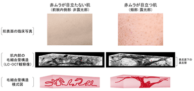 図1　非露光部と露光部の肌内部構造の違い