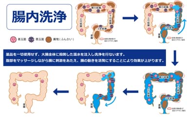 腸内洗浄流れ