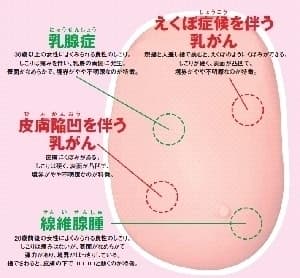 ※2 これらの触診体験ができます