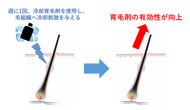 図1：週に1回の冷却刺激により育毛効果が向上