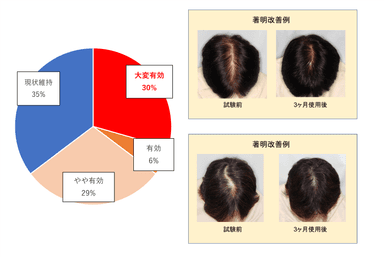 図3：週に1回の冷却刺激により65％のヒトに育毛効果を確認