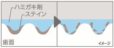 歯の表面のミクロなキズに残った汚れ除去(1)