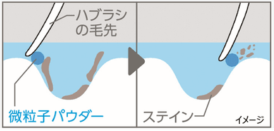 歯の表面のミクロなキズに残った汚れ除去(2)