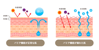 アトピー性皮膚炎の方の共通の肌状態