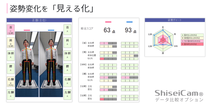 姿勢の変化の見える化で健康づくり　
キッセイコムテック、姿勢計測システムShiseiCam(R)　
データ比較オプション機能を追加