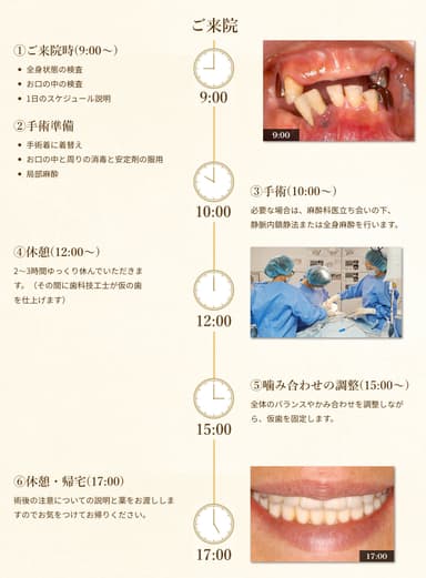 抜歯から即時荷重(噛めるようになる)までの流れ