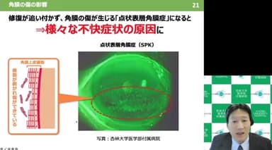 デジタル社会の進展で増大する角膜の傷リスク～目の酷使による角膜の傷への影響とその対処法～(山田先生)