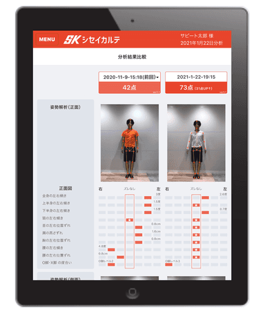 AI姿勢分析ツール「シセイカルテ」