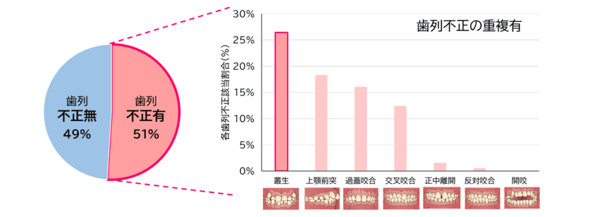 ライオン×青森県黒石市×弘前大学の共同研究　
歯並びの状態と日常の生活習慣や癖が関係する可能性を確認