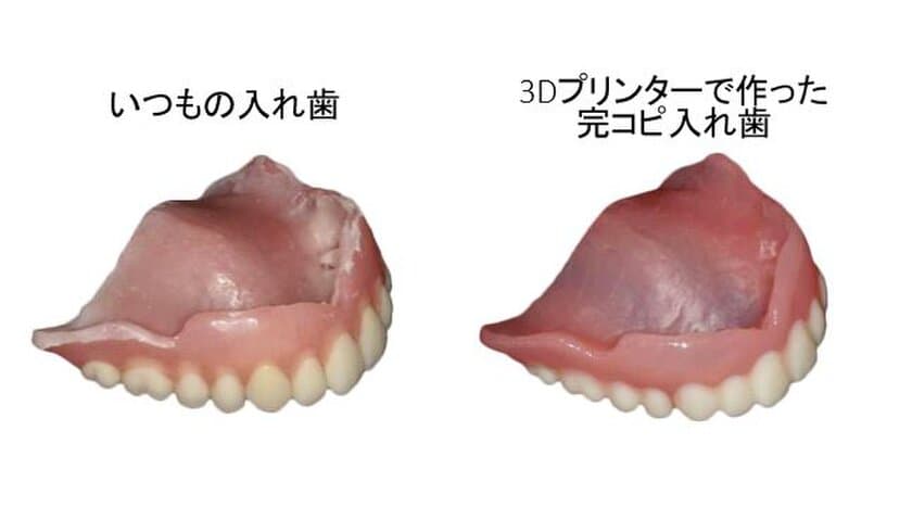 人の入れ歯は使えない！防災意識の高まりで注目の予備入れ歯　
3Dプリンターで完コピに。開始から500個突破！