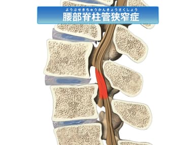 手術説明コンテンツ(動画)