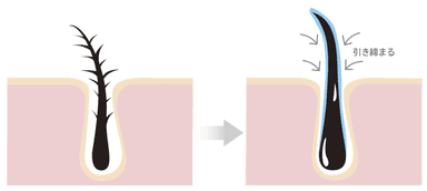 まつ毛のキューティクルを引き締める