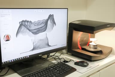 7. 入れ歯データスキャン中のPC読み取り専用機械