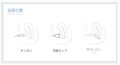 慣れると簡単、MOLARAは子宮内に挿入する