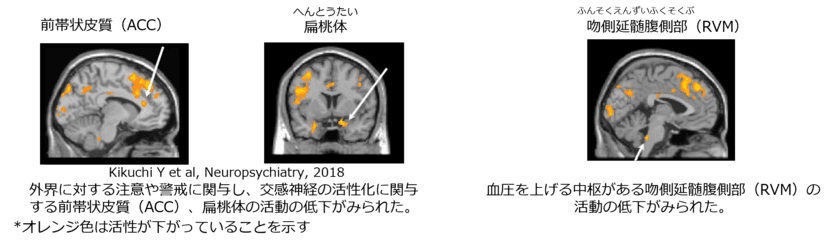 資生堂が肌のセルフタッチで幸福度が増すことを解明