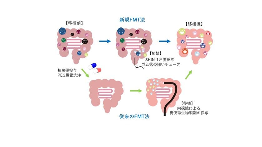 5歳から12歳の自閉スペクトラム症のお子さんを対象に、
新規糞便微生物移植法(新規FMT法)の臨床研究を開始