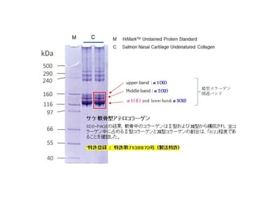 電気泳動画像