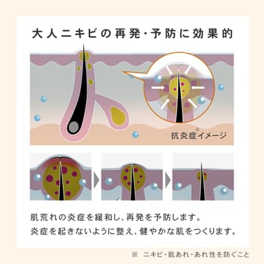 低刺激で負担の少ない、抗炎症*2作用のある有効成分