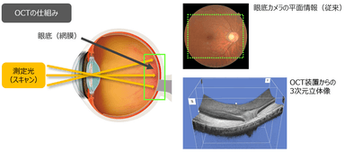 OCTの仕組み