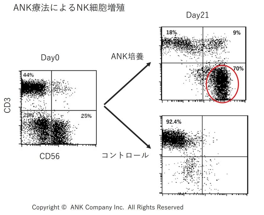 進行性びまん性大細胞型B細胞リンパ腫に対する
ANK療法著効例がWorld Journal of Clinical Casesに掲載　
リンパ球バンクがANK免疫細胞療法のための培養センターを提供