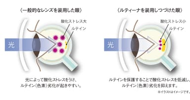 ルティーナ装用イメージ