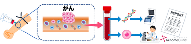 がんリキッドバイオプシー説明図