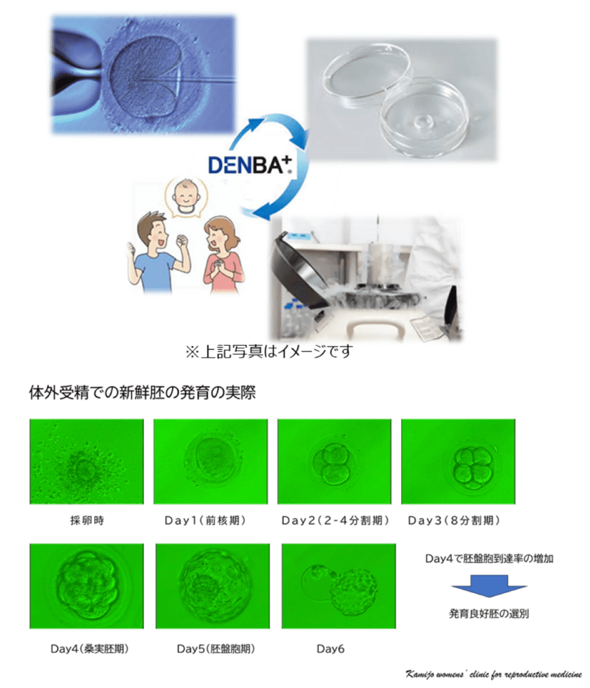 DENBAの技術が不妊治療に新たなソリューションを提供　
体外受精胚移植における妊娠および分娩率(生児獲得率)が大幅向上