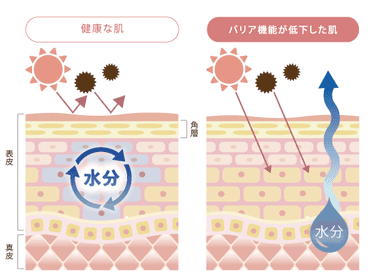 肌のバリア機能低下の仕組み