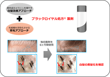 図1：2つのアプローチにより白髪を改善