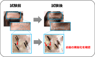 図3：明確な白髪の改善を複数確認