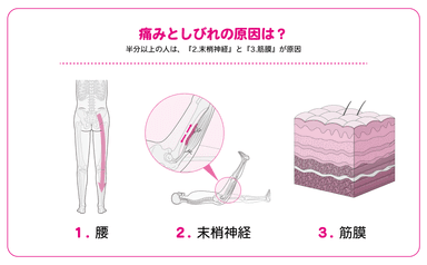 半分以上の人は、『2.末梢神経』と『3.筋膜』が原因