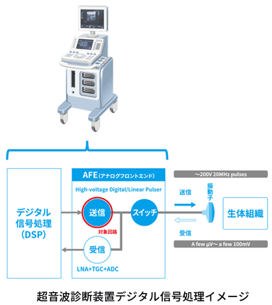 超音波診断装置デジタル信号処理イメージ