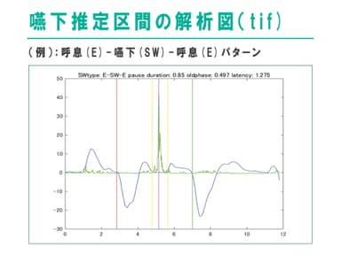 嚥下推定区間の解析図