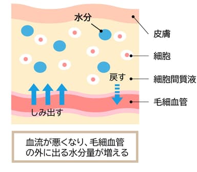 むくんでいる様子