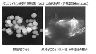 バンコマイシン感受性腸球菌(VSE)の自己融解